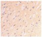 APP Antibody (CT)